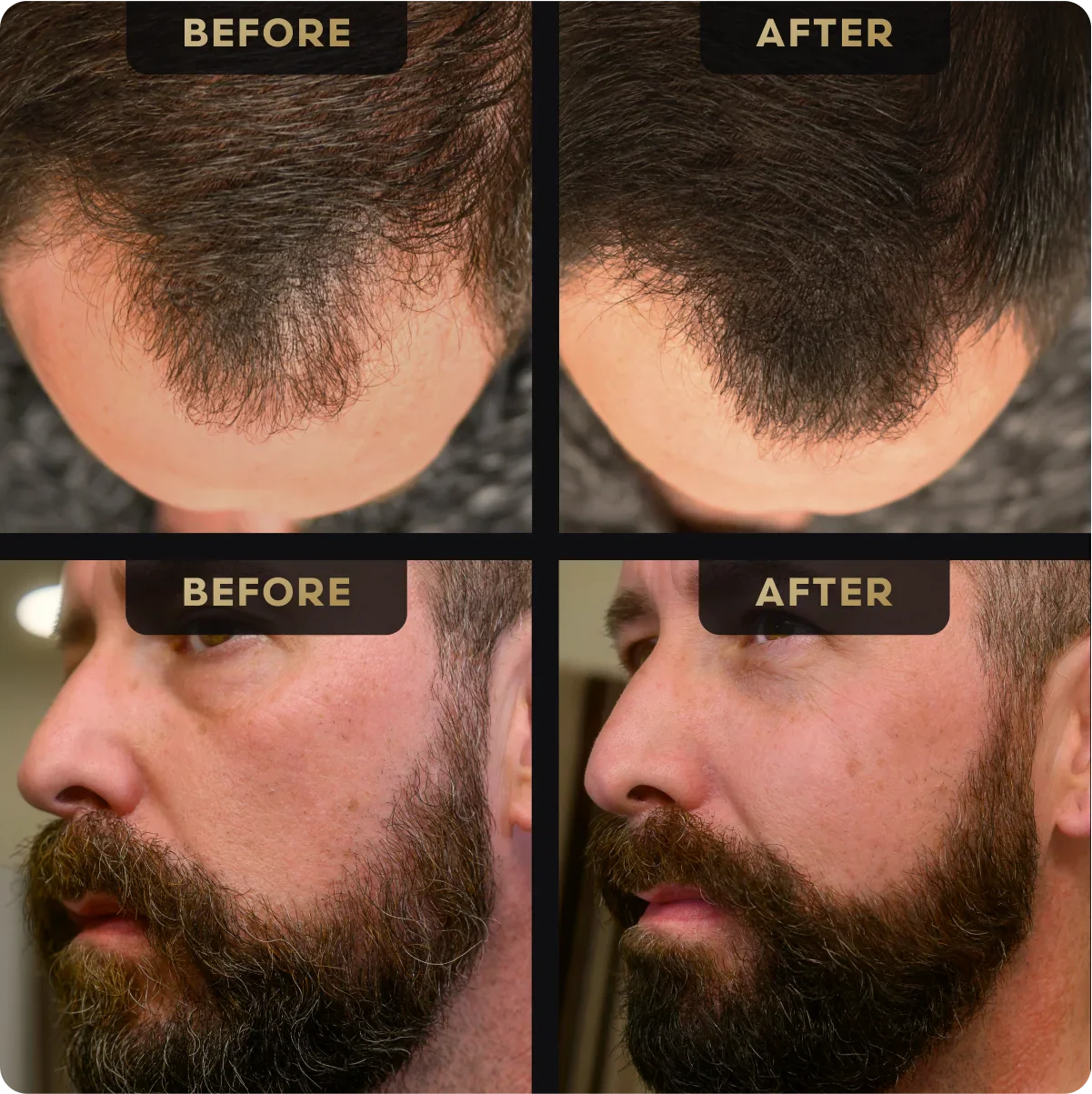 Bartstift- und Haar-Concealer-Paket